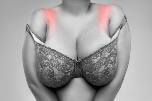 breast reduction paris