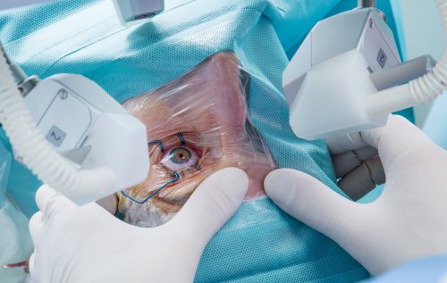cataract surgery abroad 