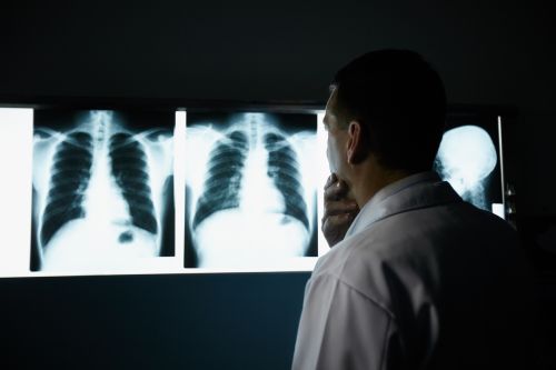 pulmonary metastases treatment 