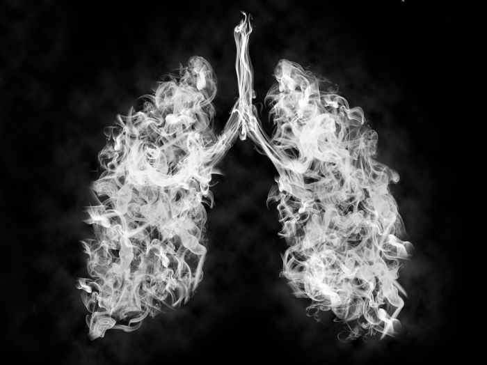 обследование лёгких за границей