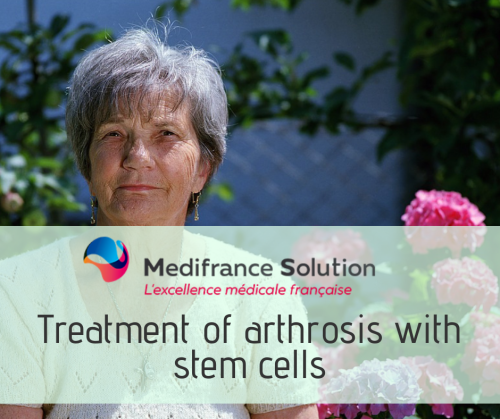 stem cells treatment ARTHROSIS