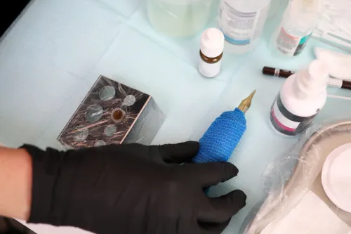 закрашивание пятен витилиго